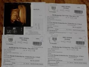 lam giay kham thai gia2