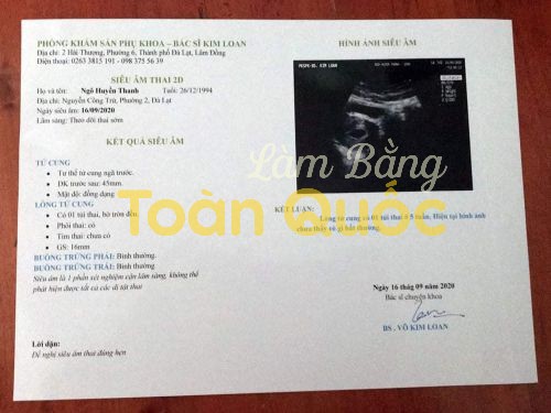 lam giay kham thai gia4